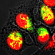 Illustration for article titled Nanotech And Lasers Team Up To Cure Cancer